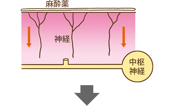 注射の前に麻酔薬をつける